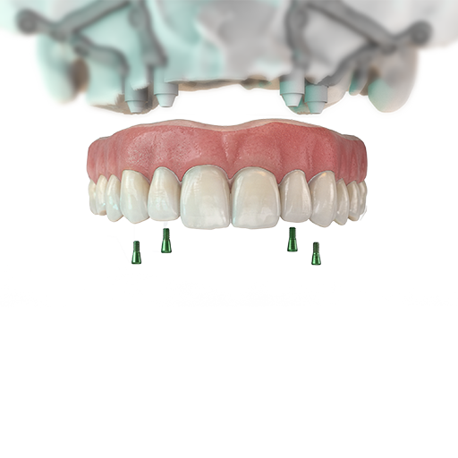 Post Surgical Over denture