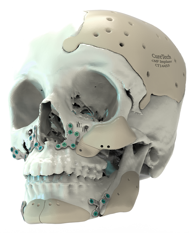 Advanced Virtual Surgical Planning VSP 3D Software